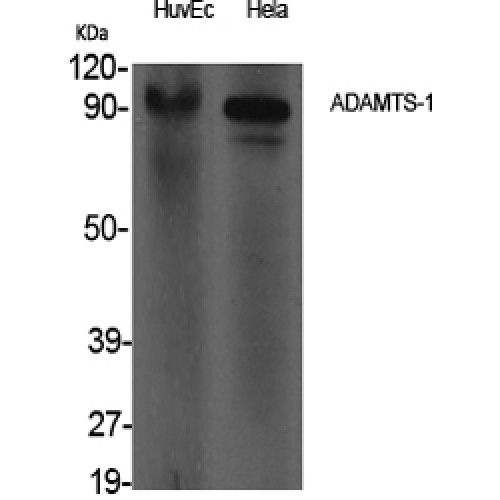ADAMTS1 Antibody - Western blot of ADAMTS-1 antibody