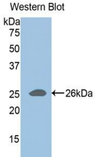 ADAMTS1 Antibody - Western blot of recombinant ADAMTS1.  This image was taken for the unconjugated form of this product. Other forms have not been tested.