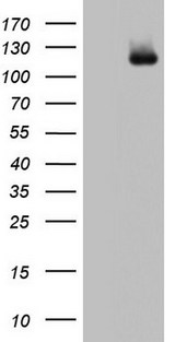 ADAMTS1 Antibody - HEK293T cells were transfected with the pCMV6-ENTRY control (Left lane) or pCMV6-ENTRY ADAMTS1 (Right lane) cDNA for 48 hrs and lysed. Equivalent amounts of cell lysates (5 ug per lane) were separated by SDS-PAGE and immunoblotted with anti-ADAMTS1.