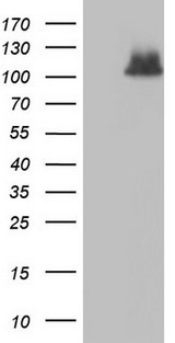 ADAMTS1 Antibody - HEK293T cells were transfected with the pCMV6-ENTRY control. (Left lane) or pCMV6-ENTRY ADAMTS1. (Right lane) cDNA for 48 hrs and lysed. Equivalent amounts of cell lysates. (5 ug per lane) were separated by SDS-PAGE and immunoblotted with anti-ADAMTS1.