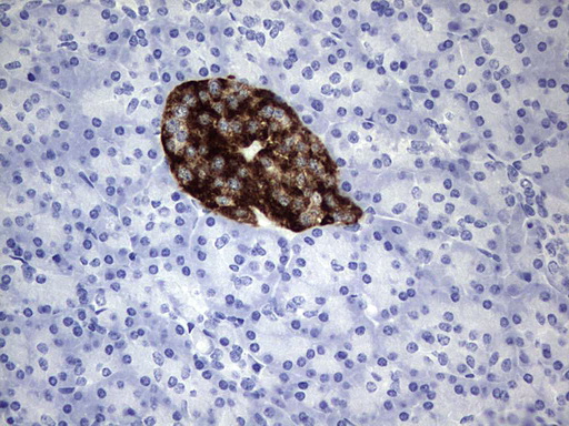 ADAMTS1 Antibody - Immunohistochemical staining of paraffin-embedded Human pancreas tissue within the normal limits using anti-ADAMTS1 mouse monoclonal antibody. (Heat-induced epitope retrieval by 1 mM EDTA in 10mM Tris, pH8.5, 120C for 3min,