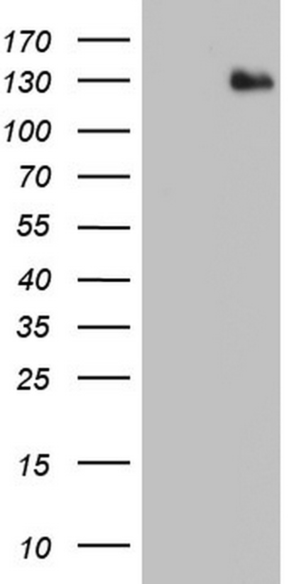 ADAMTS1 Antibody - HEK293T cells were transfected with the pCMV6-ENTRY control. (Left lane) or pCMV6-ENTRY ADAMTS1. (Right lane) cDNA for 48 hrs and lysed. Equivalent amounts of cell lysates. (5 ug per lane) were separated by SDS-PAGE and immunoblotted with anti-ADAMTS1.
