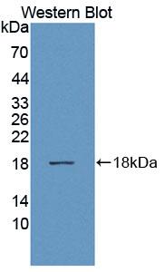 ADAMTS1 Antibody - Western Blot; Sample: Recombinant protein.