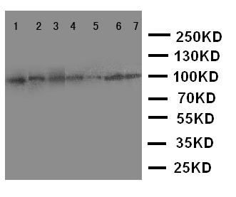 ADAMTS1 Antibody - WB of ADAMTS1 antibody. Lane 1: Rat Liver Tissue Lysate. Lane 2: Rat Heart Tissue Lysate. Lane 3: Rat Brain Tissue Lysate. Lane 4: HELA Cell Lysate. Lane 5: COLO320 Cell Lysate. Lane 6: MCF-7 Cell Lysate. Lane 7: A549 Cell Lysate.