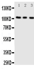 ADAMTS1 Antibody - Anti-ADAMTS1 antibody, Western blotting All lanes: Anti ADAMTS1 at 0.5ug/ml Lane 1: Rat Liver Tissue Lysate at 50ug Lane 2: Rat Heart Tissue Lysate at 50ug Lane 3: Rat Brain Tissue Lysate at 50ug Predicted bind size: 105KD Observed bind size: 105KD