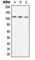 ADAMTS1 Antibody - Western blot analysis of ADAMTS1 expression in A549 (A); SW480 (B); HeLa (C) whole cell lysates.