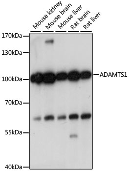 ADAMTS1 Antibody - Western blot analysis of extracts of various cell lines, using ADAMTS1 antibody at 1:1000 dilution. The secondary antibody used was an HRP Goat Anti-Rabbit IgG (H+L) at 1:10000 dilution. Lysates were loaded 25ug per lane and 3% nonfat dry milk in TBST was used for blocking. An ECL Kit was used for detection and the exposure time was 1s.