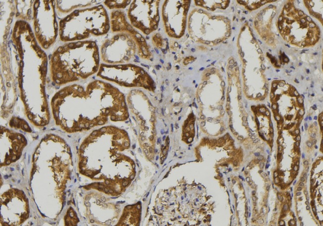 ADAMTS1 Antibody - 1:100 staining mouse kidney tissue by IHC-P. The sample was formaldehyde fixed and a heat mediated antigen retrieval step in citrate buffer was performed. The sample was then blocked and incubated with the antibody for 1.5 hours at 22°C. An HRP conjugated goat anti-rabbit antibody was used as the secondary.