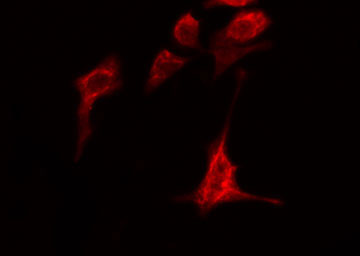 ADAMTS1 Antibody - Staining HeLa cells by IF/ICC. The samples were fixed with PFA and permeabilized in 0.1% Triton X-100, then blocked in 10% serum for 45 min at 25°C. The primary antibody was diluted at 1:200 and incubated with the sample for 1 hour at 37°C. An Alexa Fluor 594 conjugated goat anti-rabbit IgG (H+L) antibody, diluted at 1/600, was used as secondary antibody.