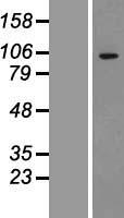 ADAMTS1 Protein - Western validation with an anti-DDK antibody * L: Control HEK293 lysate R: Over-expression lysate