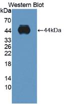 ADAMTS10 Antibody - Western Blot; Sample: Recombinant protein.