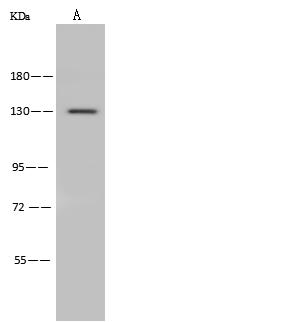 ADAMTS10 Antibody - Anti-ADAMTS10 rabbit polyclonal antibody at 1:500 dilution. Lane A: Mouse brain tissue lysate. Lysates/proteins at 30 ug per lane. Secondary: Goat Anti-Rabbit IgG (H+L)/HRP at 1/10000 dilution. Developed using the ECL technique. Performed under reducing conditions. Predicted band size: 121 kDa. Observed band size: 130 kDa.
