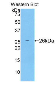 ADAMTS12 Antibody - Western blot of ADAMTS12 antibody using partial recombinant ADAMTS12.
