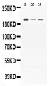 ADAMTS13 Antibody - Western blot - Anti-ADAMTS13 Picoband Antibody