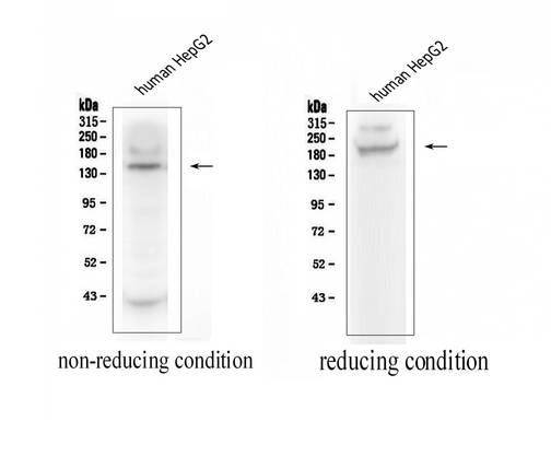 ADAMTS13 Antibody - Western blot analysis of ADAMTS13 using anti-ADAMTS13 antibody. Western blot analysis of ADAMTS13 expression in human HepG2 whole cell lysates 50ug, ADAMTS13 at 154KD under non-reducing conditions and 200 kD under reducing conditions were detected using rabbit anti-ADAMTS13 Antigen Affinity purified polyclonal antibody at 0.5ug/mL. The blot was developed using chemiluminescence (ECL) method.