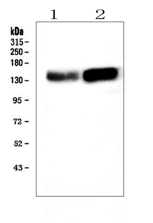 ADAMTS13 Antibody - Western blot analysis of ADAMTS13 using anti-ADAMTS13 antibody. Electrophoresis was performed on a 5-20% SDS-PAGE gel at 70V (Stacking gel) / 90V (Resolving gel) for 2-3 hours. The sample well of each lane was loaded with 50ug of sample under reducing conditions. Lane 1: mouse liver tissue lysates, Lane 2: rat brain tissue lysates, After Electrophoresis, proteins were transferred to a Nitrocellulose membrane at 150mA for 50-90 minutes. Blocked the membrane with 5% Non-fat Milk/ TBS for 1.5 hour at RT. The membrane was incubated with rabbit anti-ADAMTS13 antigen affinity purified polyclonal antibody at 0.5 µg/mL overnight at 4°C, then washed with TBS-0.1% Tween 3 times with 5 minutes each and probed with a goat anti-rabbit IgG-HRP secondary antibody at a dilution of 1:10000 for 1.5 hour at RT. The signal is developed using an Enhanced Chemiluminescent detection (ECL) kit with Tanon 5200 system. A specific band was detected for ADAMTS13 at approximately 154KD. The expected band size for ADAMTS13 is at 154KD.