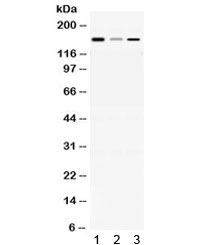 ADAMTS13 Antibody - Western blot testing of 1) rat brain, 2) mouse liver and 3) human HepG2 lysate with ADAMTS13 antibody at 0.5ug/ml. Predicted/observed molecular weight ~154 kDa.