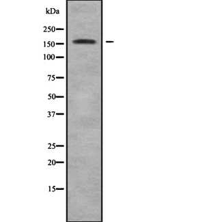 ADAMTS13 Antibody - Western blot analysis of ADAMTS13 using HeLa whole cells lysates
