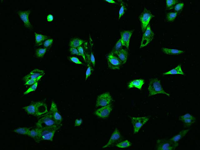 ADAMTS13 Antibody - Immunofluorescence staining of ADAMTS13 in HepG2 cells. Cells were fixed with 4% PFA, permeabilzed with 0.1% Triton X-100 in PBS, blocked with 10% serum, and incubated with rabbit anti-Human ADAMTS13 polyclonal antibody (dilution ratio 1:200) at 4°C overnight. Then cells were stained with the Alexa Fluor 488-conjugated Goat Anti-rabbit IgG secondary antibody (green) and counterstained with DAPI (blue). Positive staining was localized to Cytoplasm.