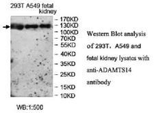 ADAMTS14 Antibody - Western blot of ADAMTS14 antibody