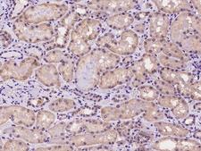 ADAMTS15 Antibody - Immunochemical staining of human ADAMTS15 in human kidney with rabbit polyclonal antibody at 1:100 dilution, formalin-fixed paraffin embedded sections.