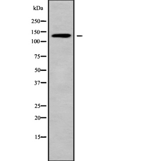 ADAMTS16 Antibody - Western blot analysis of ADAMTS16 using HuvEc whole cells lysates
