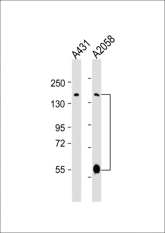 ADAMTS17 Antibody - All lanes: Anti-ADAMTS17 Antibody (Center) at 1:2000 dilution. Lane 1: A431 whole cell lysates. Lane 2: A2058 whole cell lysates Lysates/proteins at 20 ug per lane. Secondary Goat Anti-Rabbit IgG, (H+L), Peroxidase conjugated at 1:10000 dilution. Predicted band size: 121 kDa. . Blocking/Dilution buffer: 5% NFDM/TBST.