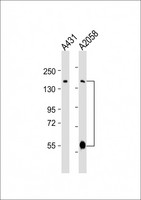 ADAMTS17 Antibody - All lanes: Anti-ADAMTS17 Antibody (Center) at 1:2000 dilution. Lane 1: A431 whole cell lysates. Lane 2: A2058 whole cell lysates Lysates/proteins at 20 ug per lane. Secondary Goat Anti-Rabbit IgG, (H+L), Peroxidase conjugated at 1:10000 dilution. Predicted band size: 121 kDa. . Blocking/Dilution buffer: 5% NFDM/TBST.