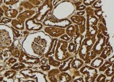 ADAMTS17 Antibody - 1:100 staining human kidney tissue by IHC-P. The sample was formaldehyde fixed and a heat mediated antigen retrieval step in citrate buffer was performed. The sample was then blocked and incubated with the antibody for 1.5 hours at 22°C. An HRP conjugated goat anti-rabbit antibody was used as the secondary.