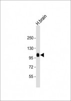 ADAMTS17 Antibody - Anti-ADAMTS17 Antibody (N-term) at 1:2000 dilution + human brain lysate Lysates/proteins at 20 µg per lane. Secondary Goat Anti-Rabbit IgG, (H+L), Peroxidase conjugated at 1/10000 dilution. Predicted band size: 121 kDa Blocking/Dilution buffer: 5% NFDM/TBST.