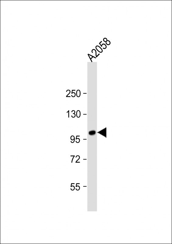 ADAMTS17 Antibody - Anti-ADAMTS17 Antibody (N-term) at 1:2000 dilution + A2058 whole cell lysate Lysates/proteins at 20 µg per lane. Secondary Goat Anti-Rabbit IgG, (H+L), Peroxidase conjugated at 1/10000 dilution. Predicted band size: 121 kDa Blocking/Dilution buffer: 5% NFDM/TBST.