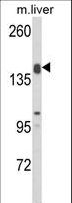 ADAMTS18 Antibody - Western blot of ADAMTS18 Antibody in mouse liver tissue lysates (35 ug/lane). ADAMTS18 (arrow) was detected using the purified antibody.