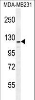 ADAMTS18 Antibody - ADAMTS18 Antibody western blot of MDA-MB231 cell line lysates (35 ug/lane). The ADAMTS18 antibody detected the ADAMTS18 protein (arrow).
