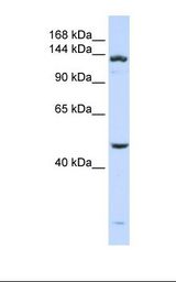 ADAMTS18 Antibody - 721_B cell lysate. Antibody concentration: 1.0 ug/ml. Gel concentration: 6-18%.  This image was taken for the unconjugated form of this product. Other forms have not been tested.