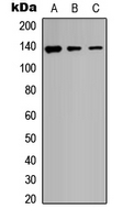 ADAMTS18 Antibody - Western blot analysis of ADAMTS18 expression in HEK293T (A); Raw264.7 (B); PC12 (C) whole cell lysates.