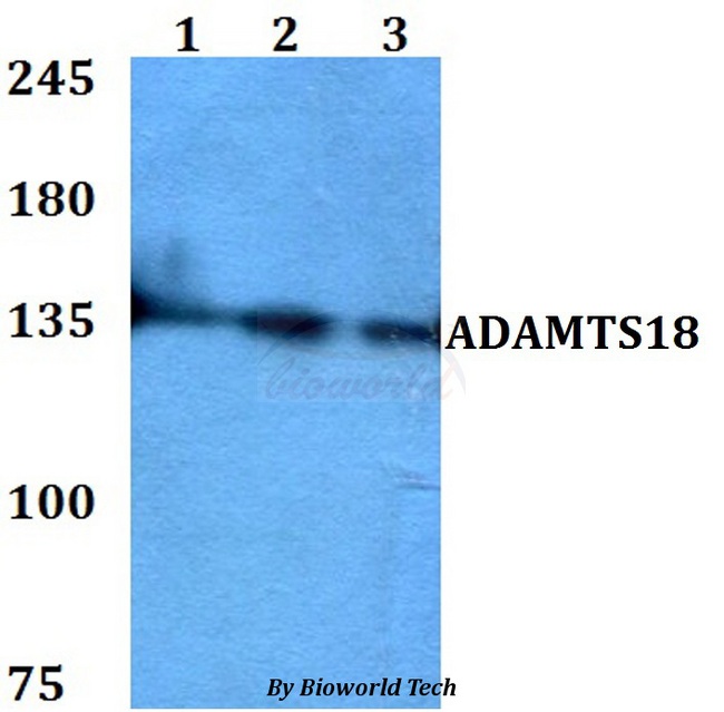 ADAMTS18 Antibody - Western blot of ADAMTS18 antibody at 1:500 dilution. Lane 1: HEK293T whole cell lysate. Lane 2: Raw264.7 whole cell lysate. Lane 3: PC12 whole cell lysate.
