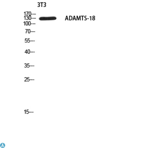ADAMTS18 Antibody - Immunohistochemistry (IHC) analysis of paraffin-embedded Human Brain, antibody was diluted at 1:200.