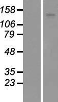 ADAMTS18 Protein - Western validation with an anti-DDK antibody * L: Control HEK293 lysate R: Over-expression lysate