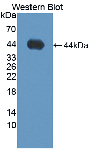 ADAMTS19 Antibody - Western blot of ADAMTS19 antibody.