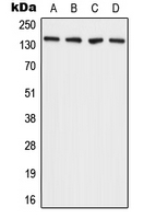 ADAMTS2 Antibody - Western blot analysis of ADAMTS2 expression in A431 (A); MCF7 (B); SP2/0 (C); H9C2 (D) whole cell lysates.