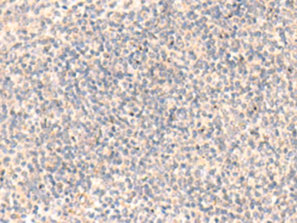 ADAMTS2 Antibody - Immunohistochemistry of paraffin-embedded Human tonsil tissue  using ADAMTS2 Polyclonal Antibody at dilution of 1:45(×200)