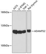ADAMTS2 Antibody - Western blot analysis of extracts of various cell lines using ADAMTS2 Polyclonal Antibody at dilution of 1:1000.