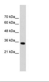 ADAMTS4 Antibody - HepG2 Cell Lysate.  This image was taken for the unconjugated form of this product. Other forms have not been tested.