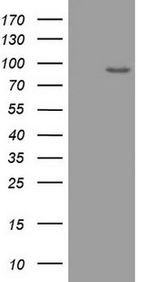 ADAMTS4 Antibody - HEK293T cells were transfected with the pCMV6-ENTRY control (Left lane) or pCMV6-ENTRY ADAMTS4 (Right lane) cDNA for 48 hrs and lysed. Equivalent amounts of cell lysates (5 ug per lane) were separated by SDS-PAGE and immunoblotted with anti-ADAMTS4.