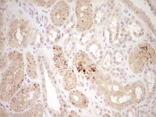 ADAMTS4 Antibody - Immunohistochemical staining of paraffin-embedded Human Kidney tissue within the normal limits using anti-ADAMTS4 mouse monoclonal antibody. (Heat-induced epitope retrieval by Tris-EDTA, pH8.0) Dilution: 1:150