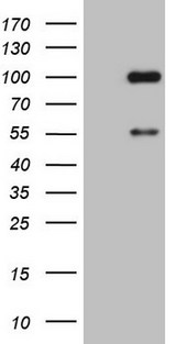 ADAMTS4 Antibody - HEK293T cells were transfected with the pCMV6-ENTRY control (Left lane) or pCMV6-ENTRY ADAMTS4 (Right lane) cDNA for 48 hrs and lysed. Equivalent amounts of cell lysates (5 ug per lane) were separated by SDS-PAGE and immunoblotted with anti-ADAMTS4.