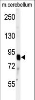 ADAMTS4 Antibody - Western blot of anti-ADAMTS4 Antibody in mouse cerebellum tissue lysates (35 ug/lane). ADAMTS4 (arrow) was detected using the purified antibody.