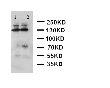 ADAMTS4 Antibody - WB of ADAMTS4 antibody. Lane 1: Rat Brain Tissue Lysate. Lane 2: Mouse Brain Tissue Lysate.
