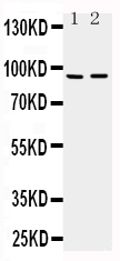 ADAMTS4 Antibody - Anti-ADAMTS4 antibody, Western blotting Lane 1: Rat Brain Tissue LysateLane 2: Mouse Brain Tissue Lysate