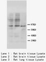 ADAMTS4 Antibody -  This image was taken for the unconjugated form of this product. Other forms have not been tested.